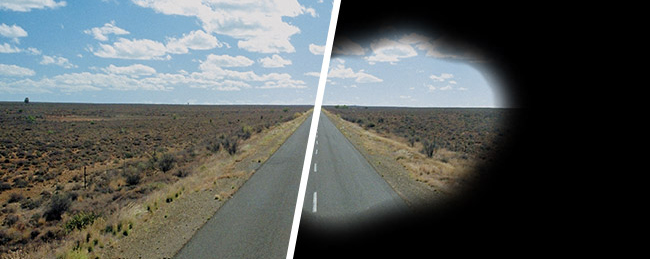 პიგმენტური რეტინიტი სიმპტომები