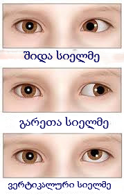 სიელმე დიაგრამა